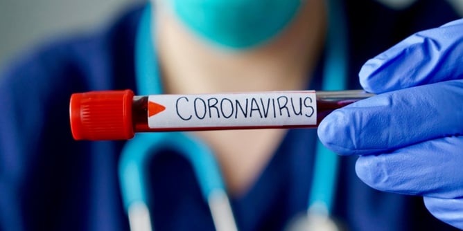 Face à l'épidémie de Coronavirus, plusieurs pays ont fermé leurs frontières
